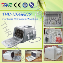 Экономичный портативный ультразвуковой сканер ноутбука (THR-US6602)